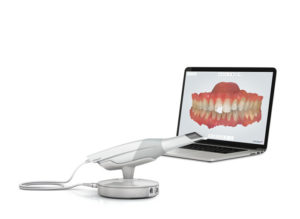Escaner intra oral 3D 3shape