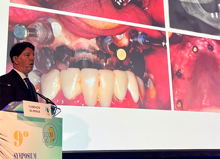 Participacion en el 9º Symposium Internacional de Implantologia “Ciudad de Oviedo”