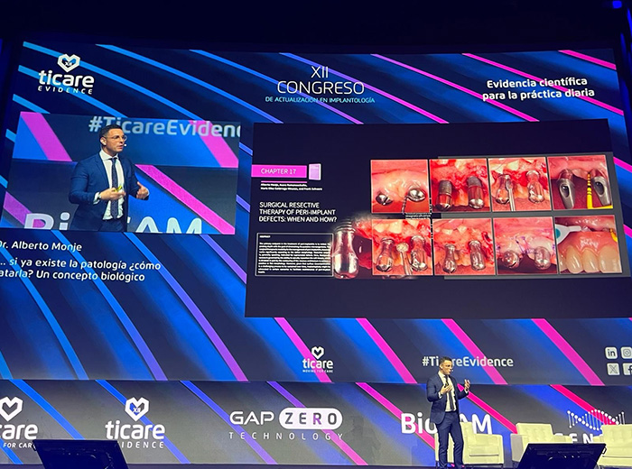 CICOM MONJE, presente en el XII Congreso de Actualización en Implantología celebrado en Madrid
