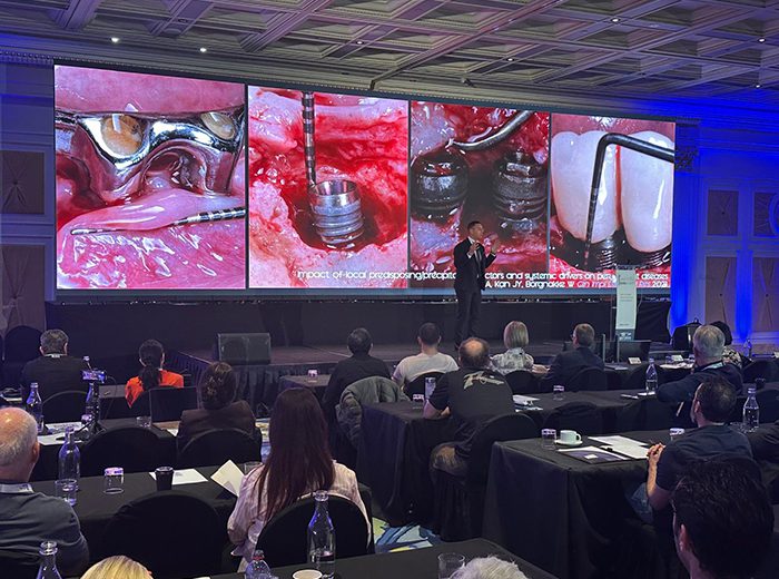 El Dr. Alberto Monje dio una charla sobre cómo prevenir y manejar complicaciones en la terapia con implantes en un simposio internacional en Australia.