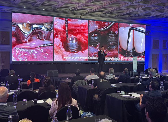 El Dr. Alberto Monje dio una charla sobre cómo prevenir y manejar complicaciones en la terapia con implantes en un simposio internacional en Australia.