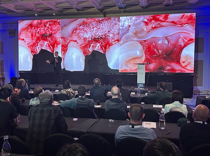 El Dr. Alberto Monje dio una charla sobre cómo prevenir y manejar complicaciones en la terapia con implantes en un simposio internacional en Australia.
