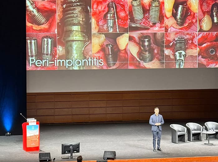 Dr. Alberto Monje, ponente en el Congreso de Periodoncia de Lyon