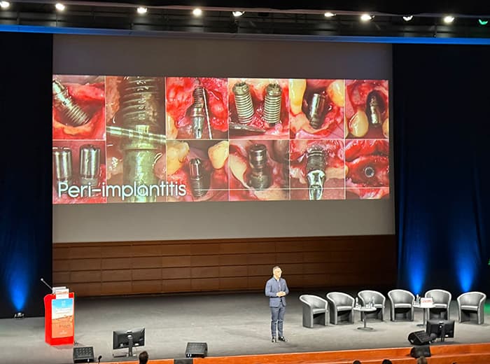 Dr. Alberto Monje, ponente en el Congreso de Periodoncia de Lyon