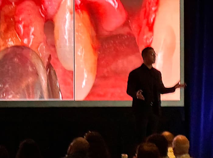 El Dr. Alberto Monje en el Pikos Symposium de Orlando sobre regeneración ósea y periimplantitis